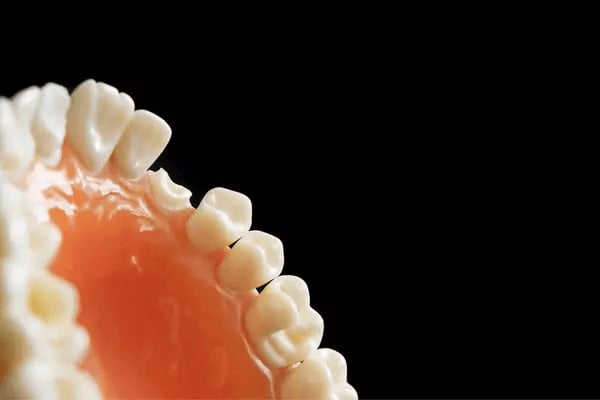 Diş Eksikliklerinin Giderilmesi-Medikament Ağız ve Diş Sağlığı Polikliniği