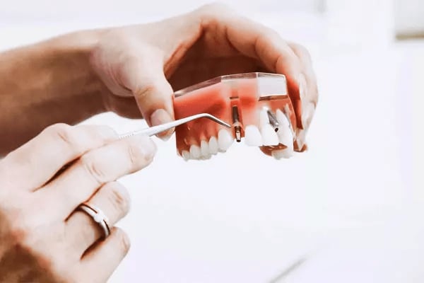 İmplant Uygulamaları-Medikament Ağız ve Diş Sağlığı Polikliniği